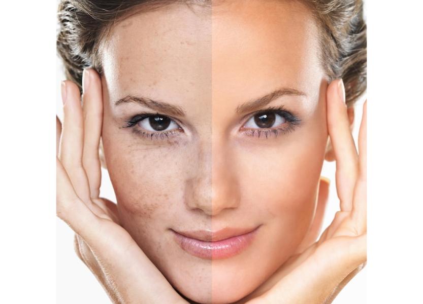 Anti Aging Treatment