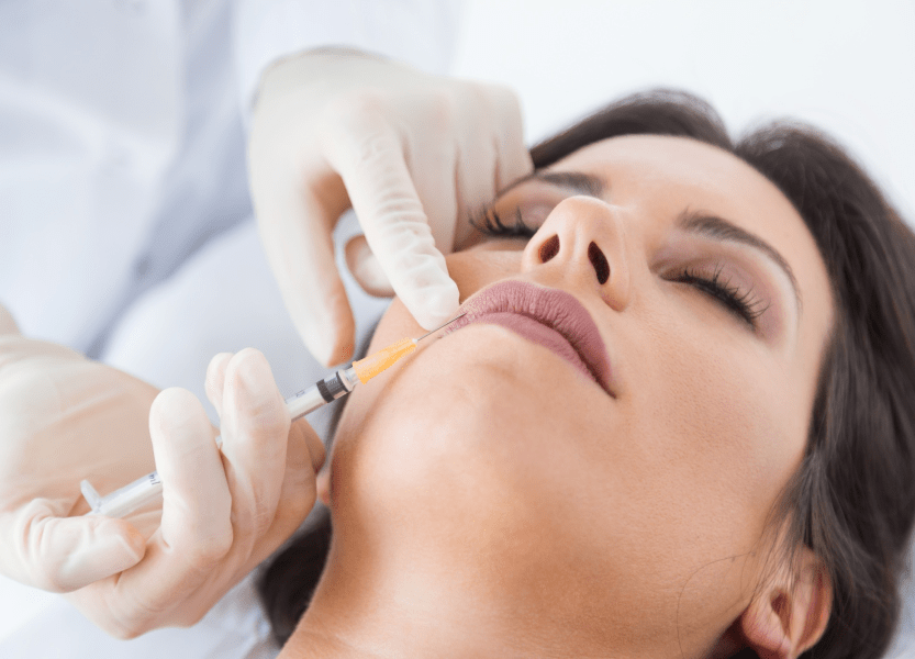 Fillers Treatment