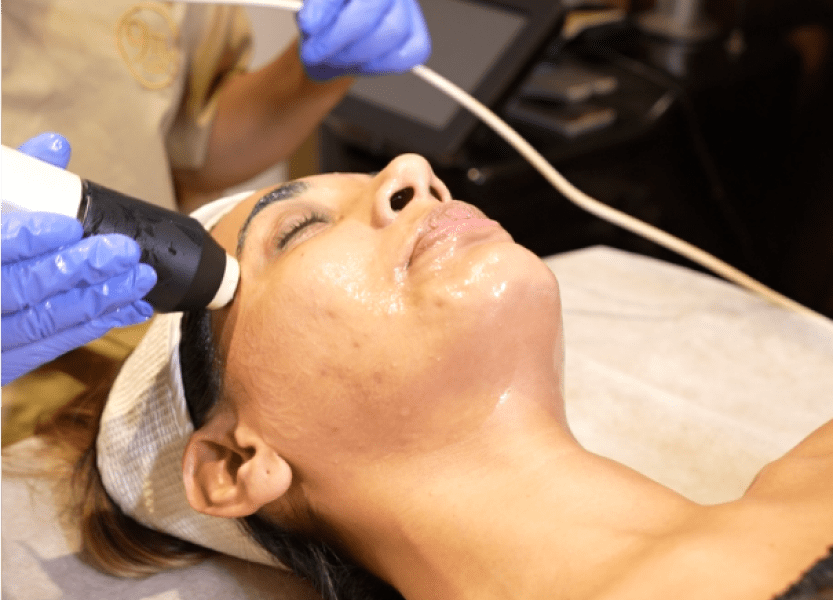 Laser Skin Rejuvenation