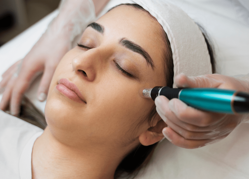 Microneedling Treatment