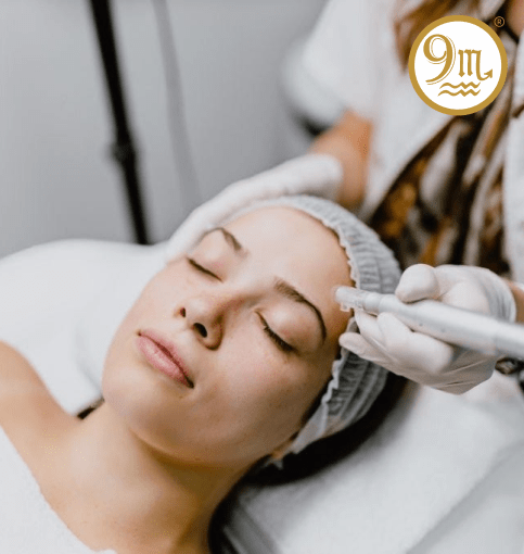 Microneedling Treatment